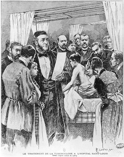 The treatment of tuberculosis at St. Louis hospital, Paris from Edward Loevy